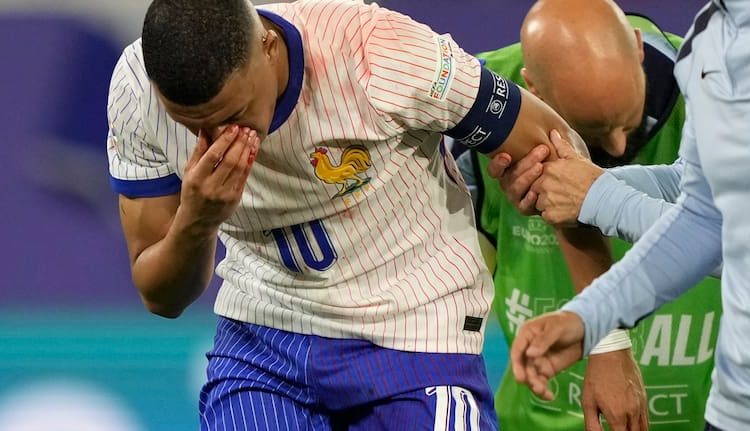Mbappe’s Euros Look Gets a Mask-over After Nose Injury